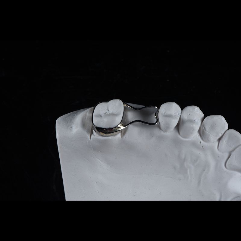 Teeth Space Retainer
