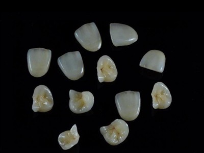 Jak wybrać najlepszy klej dentystyczny do koron: najnowszy przewodnik