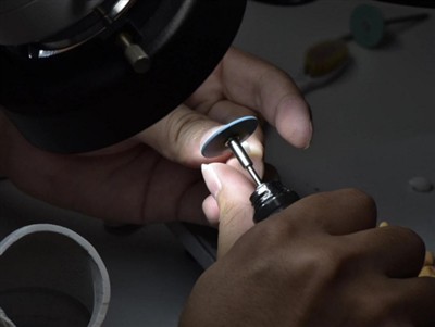 Jak długo wytrzymują korony PFM? Średnia długość życia, czynniki i wskazówki ...