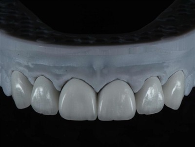 Jak zlecić pracę technika laboratorium dentystycznego za granicą: kompleksowy...